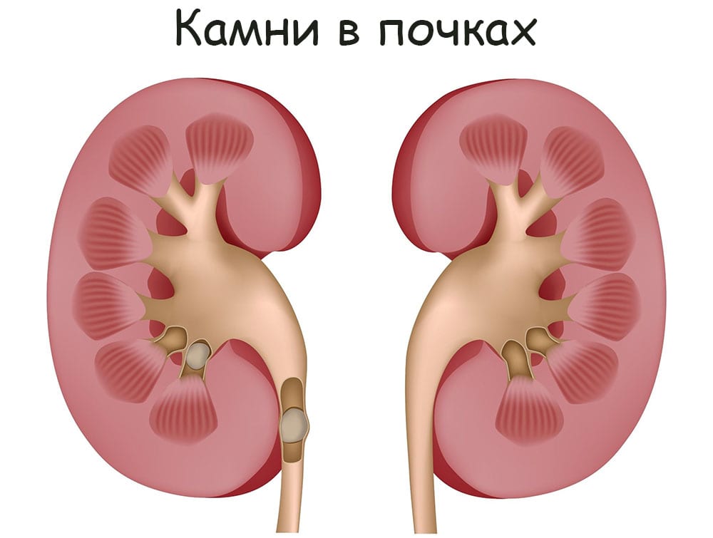 Kraken рабочая ссылка onion